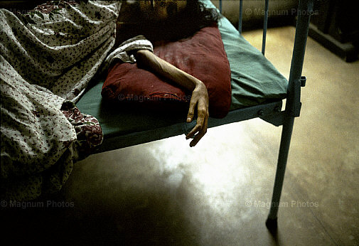 India, Calcutta. Malati di Aids, all\\'interterno del Ospedale Centrale -1.jpg