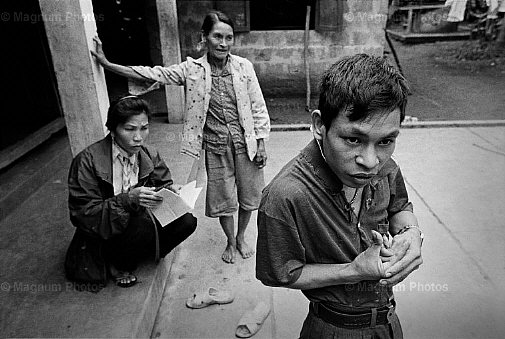 Vietnam, Cam Nghia.  Pham Hong Quy, affetto da epilessia.jpg