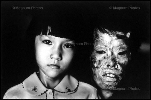 [Vietnam.] Bambina, con la madre sfigurata dal napalm.jpg